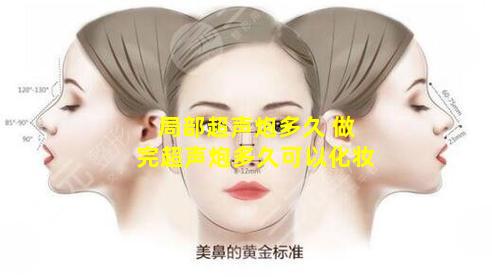 局部超声炮多久 做完超声炮多久可以化妆